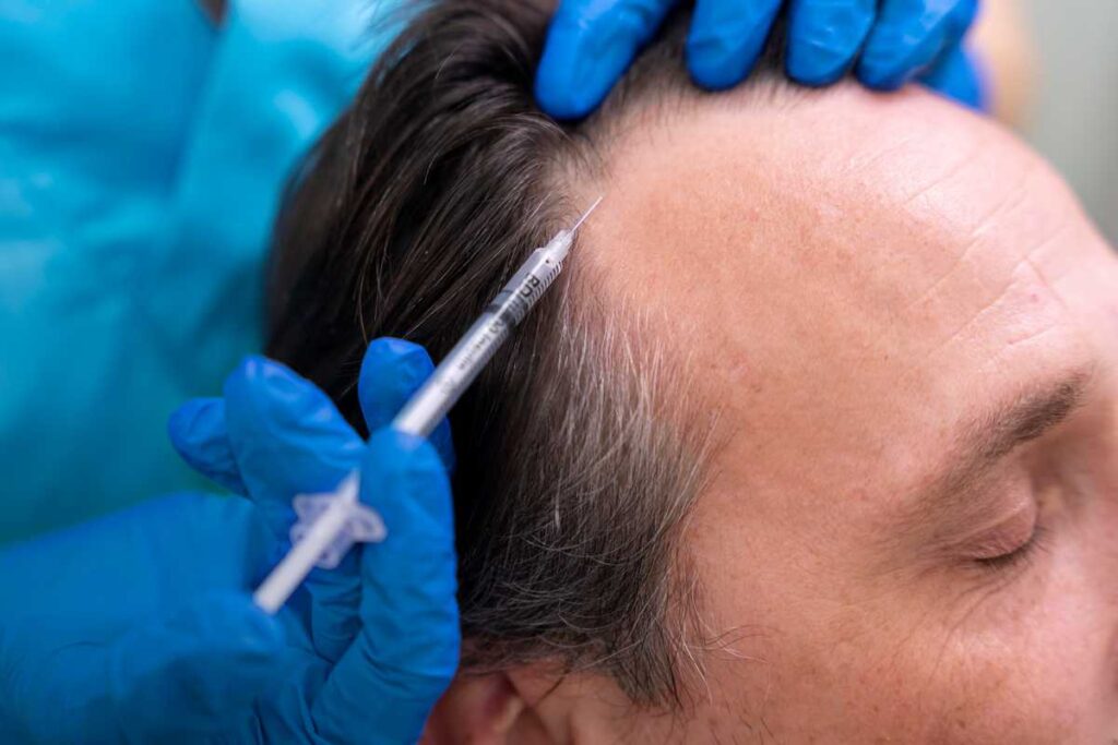 Surgical Hair Loss Treatment of Hair Loss Problem in Men in kolkata howrah west bengal non-surgical hair replacement centre