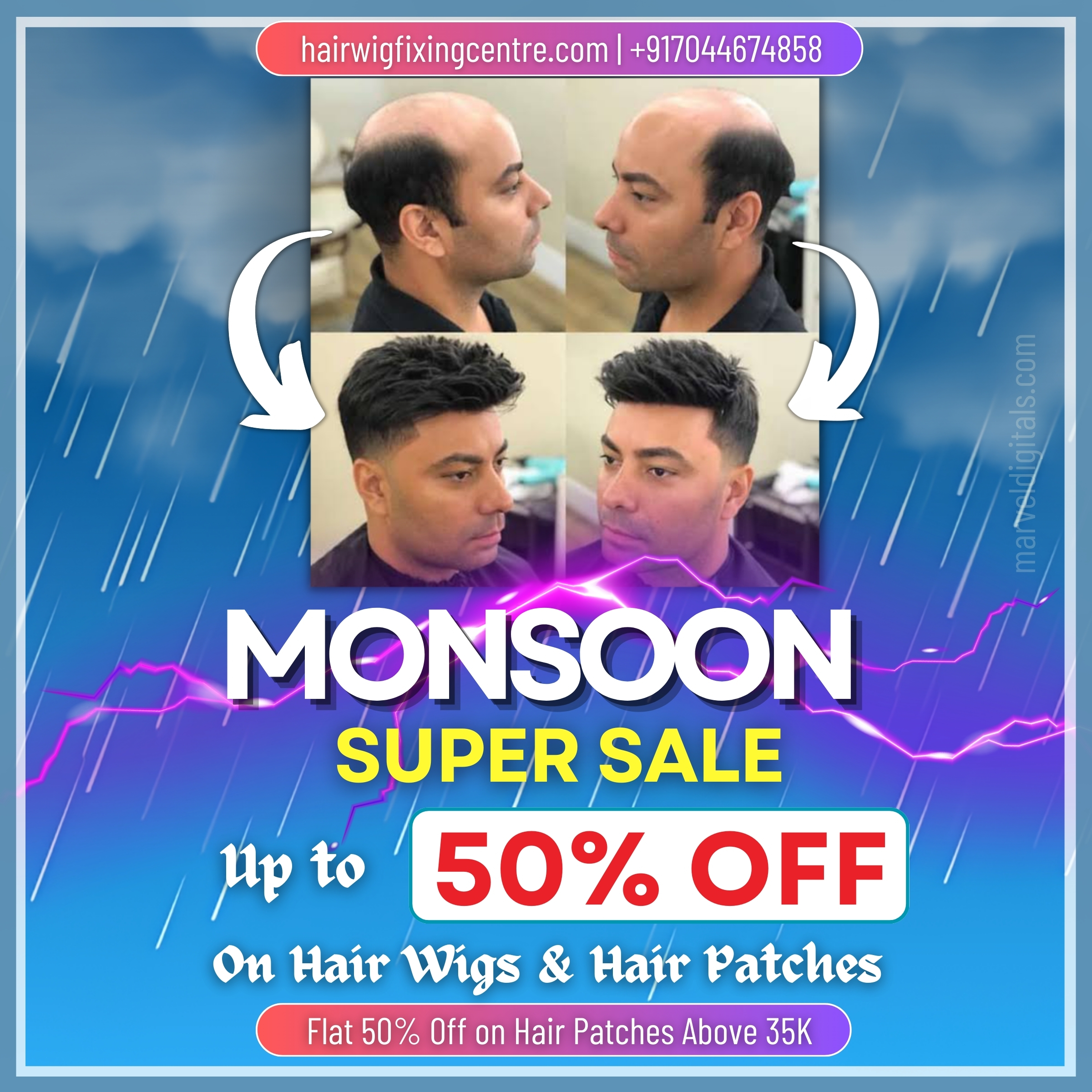 Get back hair style with non-surgical hair replcaement in kolkata, starting just ₹5999. Monsoon offer on hair wigs and hair patches with up to 50% Off on all hair wigs and hair patches above hair wigs of 35 thousand.
