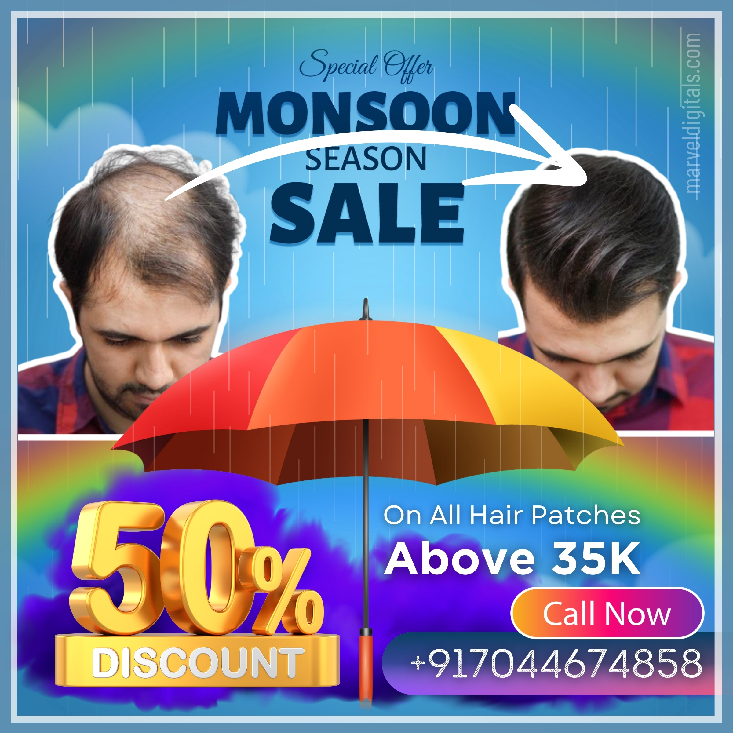Get back hair style with non-surgical hair replcaement in kolkata, starting just ₹5999. Monsoon offer on hair wigs and hair patches with up to 50% Off on all hair wigs and hair patches above hair wigs of 35 thousand.