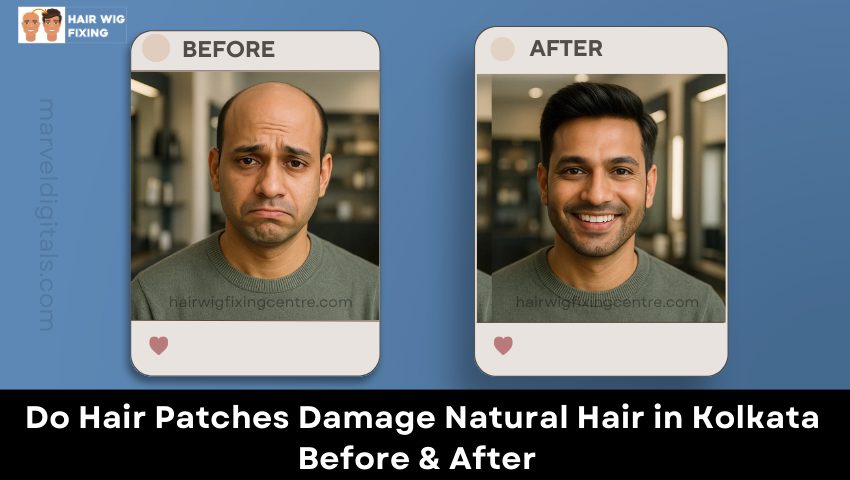 Before and after results of hair patch fixing in Kolkata showing natural hair restoration for men.