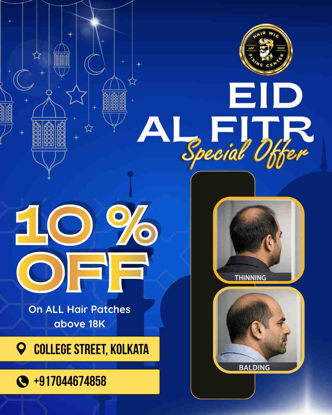 Eid festival 10 percent off on hair wig fixing and hair patch in College Street Kolkata
