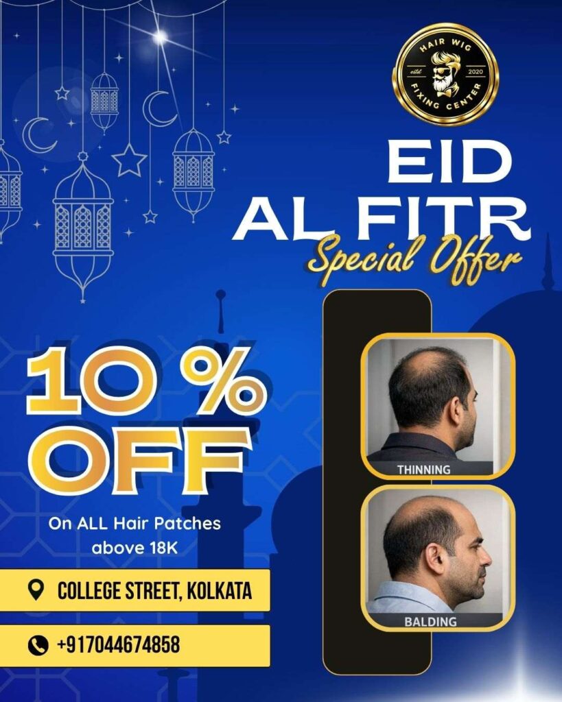Eid festival 10 percent off on hair wig fixing and hair patch in College Street Kolkata