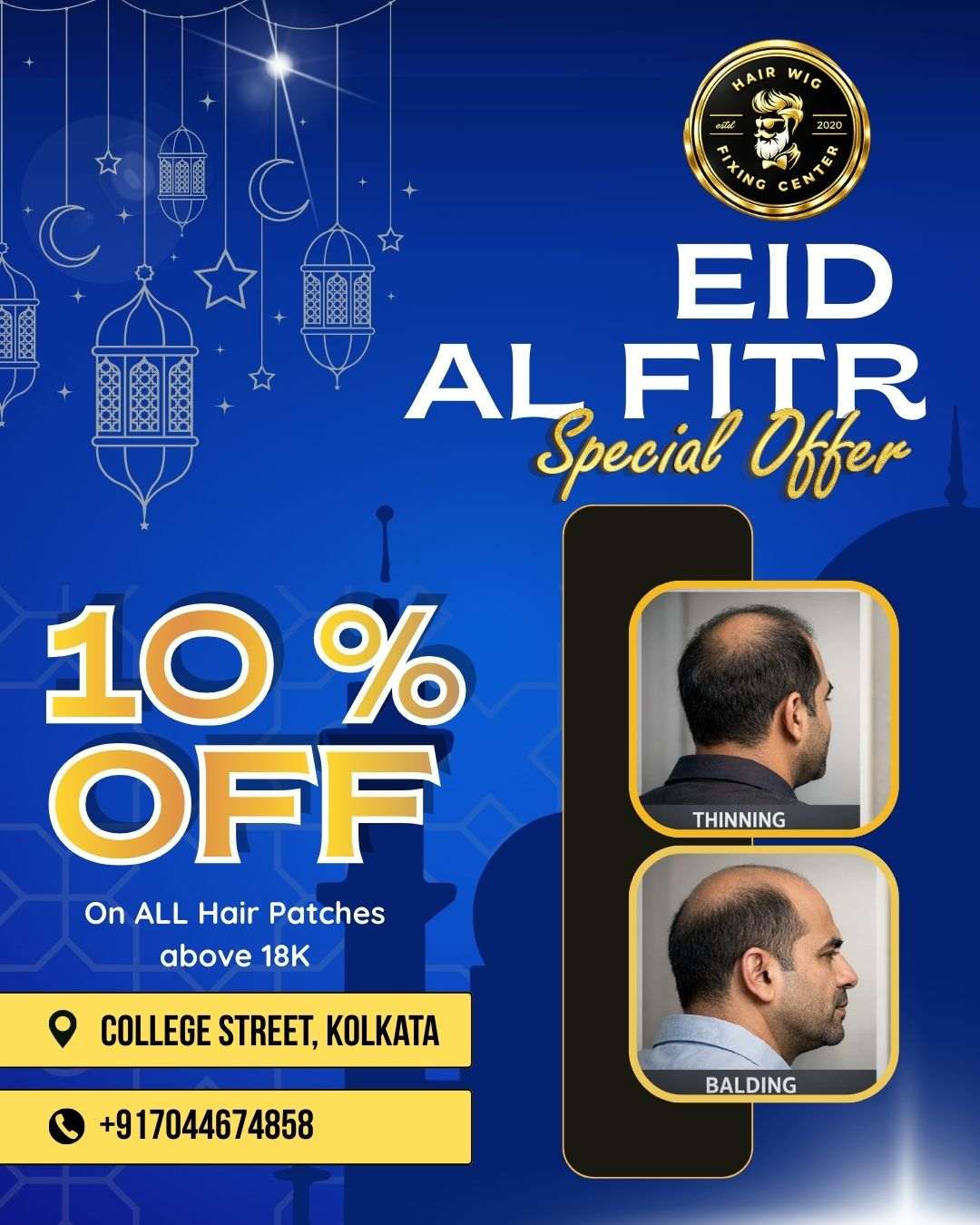 Eid festival 10 percent off on hair wig fixing and hair patch in College Street Kolkata